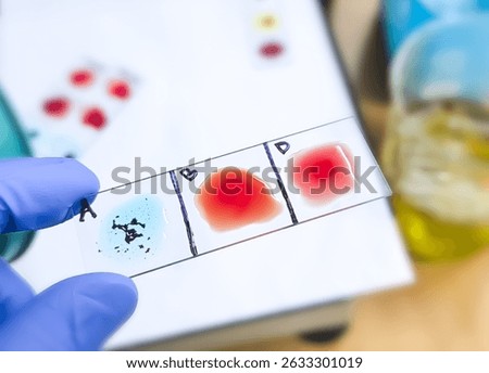 Blood group and Rh factor testing by slide agglutination method. Blood typing. A Negative (A-) blood group, a rare type of blood group.