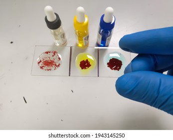 120 Slide agglutination method Images, Stock Photos & Vectors ...