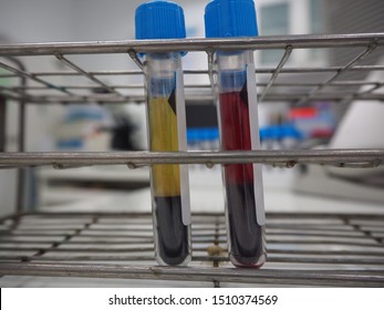 Blood Hemolysis And Blood Not Hemolysis In Citrate Tube