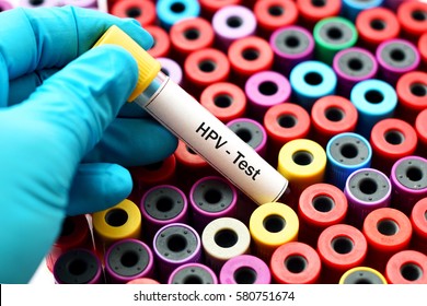 Blood for HPV test