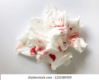 Blood On Tissue Paper Form Nosebleed 