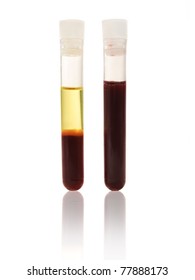 Blood And Plasma In Test Tube Reflected On White Table, Experimental Studies Of Red Blood Cell (RBC) And Plasma In Research Laboratory