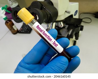 Blood For Renal Function Test