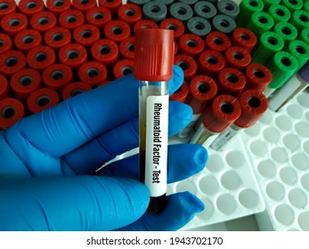 Blood For Rheumatoid Factor Test