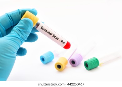 Blood For Rheumatoid Factor Test