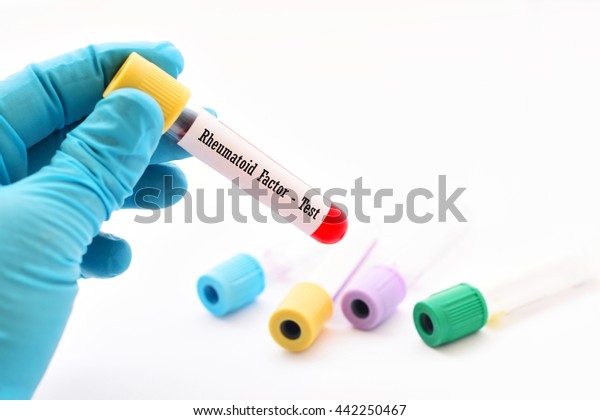 rheumatoid factor blood test 7