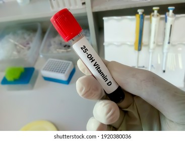 Blood sample for 25 (OH) vitamin D test