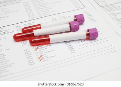 Blood Sample