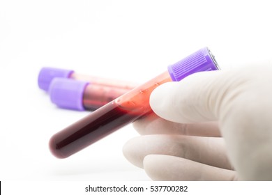 Blood Sample