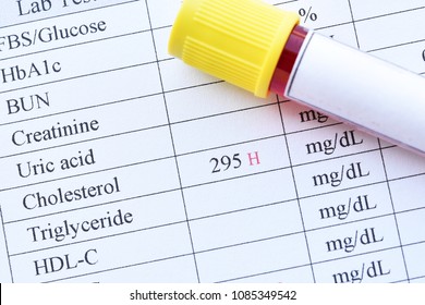 Blood Sample With Abnormal High Cholesterol Test Result