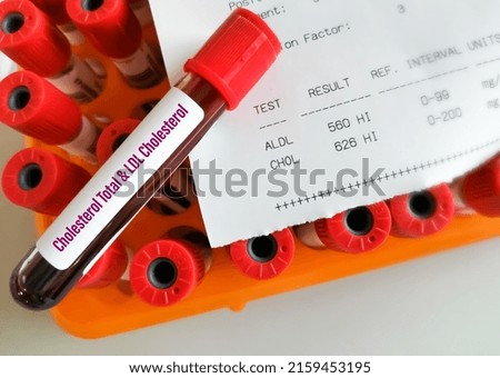 Blood sample with abnormal high report of cholesterol total and ldl cholesterol test.
