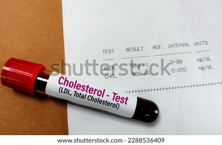 Blood sample with abnormal high report of Total Cholesterol and LDL cholesterol test.