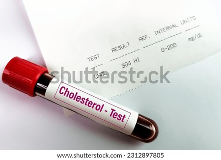 Blood sample with abnormal high report of Cholesterol test.