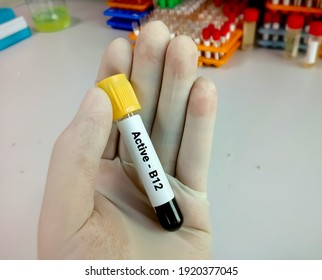Blood Sample For Active Vitamin B12 Test