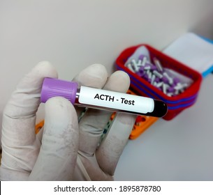 Blood sample for Adrenocorticotropic hormone (ACTH) test, diagnosis of Addison's disease
