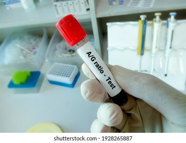 low ag ratio blood test