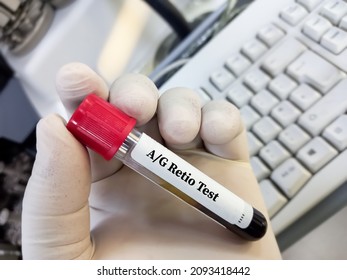low ag ratio blood test