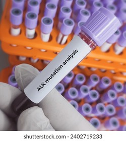 Blood sample for ALK (Anaplastic Lymphoma Kinase) test, ALK mutation analysis.