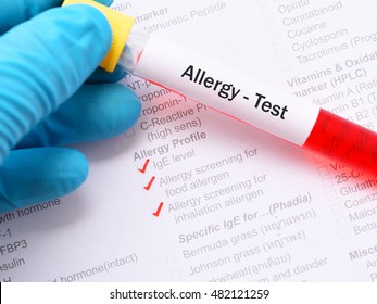 Blood Sample For Allergy Test