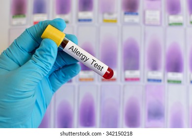 Blood Sample For Allergy Testing