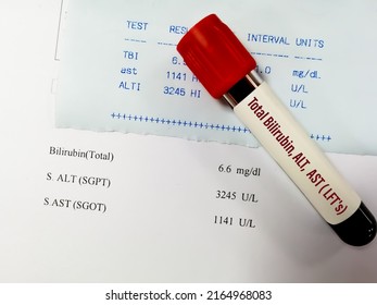 Blood Sample For ALT, AST And Total Bilirubin Test With Abnormal Report. LFTs Or Liver Function Tests.