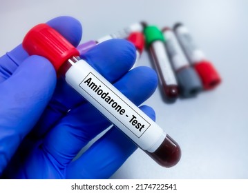 Blood Sample For Amiodarone Level Test, To Set Therapeutic Range Of Amiodarone A Drug To Prevent Cardiac Arrhythmia.