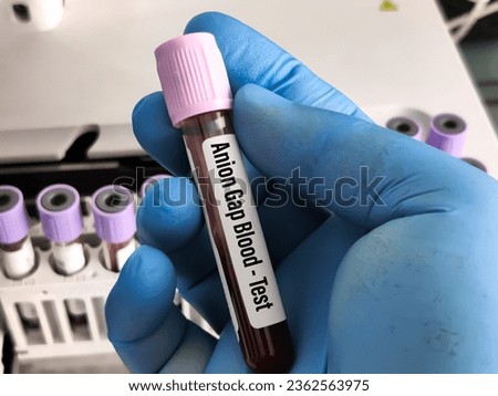 Blood sample for Anion Gap test to diagnose electrolytes balance including too acidic (acidosis) or little acidic (alkalosis)