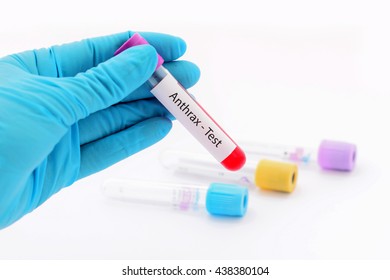 Blood Sample For Anthrax Test