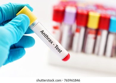 Blood Sample For Anthrax Test