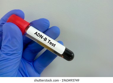 Blood sample for Anti-DNase B or ADN-B test