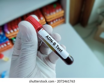 Blood sample for Anti-DNase B or ADN-B test. Medical test tube in laboratory background.