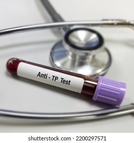 Blood Sample For Anti-TP(Treponema Pallidum) Test. Diagnosis Syphilis Infection. STDs, STI.