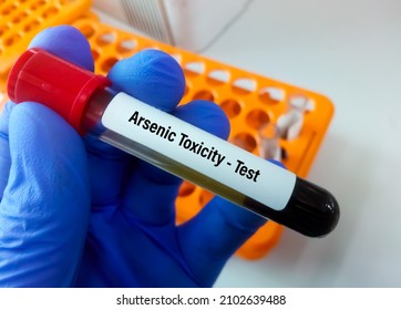 Blood Sample For Arsenic Toxicity Test. Arsenic Is A Heavy Metal Element. High Levels Of Arsenic May Have Arsenic Poisoning