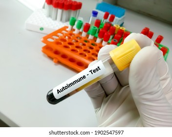 Blood sample for autoimmune disease test. diagnosis of autoimmune disorder