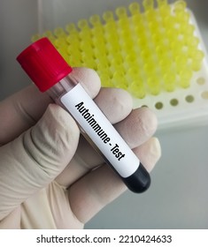 Blood Sample For Autoimmune Disease Test. Autoimmune Disorder.