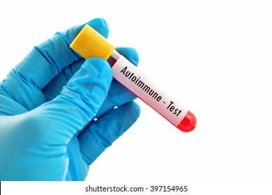 Blood Sample For Autoimmune Disease Test
