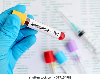 Blood sample for autoimmune disease test
