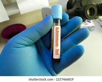Blood sample for Autoimmune test. To diagnosis autoimmune disease at medical laboratory.