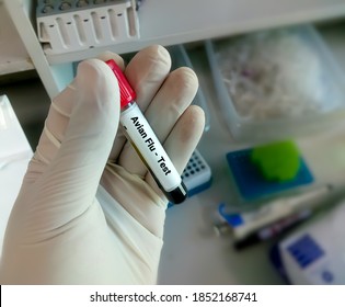 Blood sample for Avian Flu test