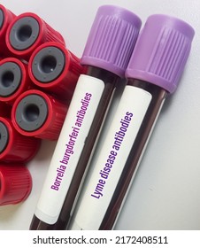 Blood sample for Borrelia burgdorferi antibody test, Lyme disease antibodies test, to diagnosis fo Lyme disease.