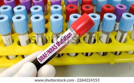 Blood sample for BRAF-NRAS Mutation testing is done to look for genetic changes in tumors that are present in some cancers, including metastatic melanoma, lung cancer, colon cancer