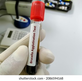 Blood Sample For Brucella Agglutination Test.