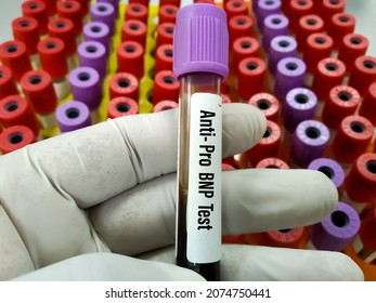 Blood Sample For B-type Natriuretic Peptide Or BNP Test, Cardiac Marker For Acute Or Chronic Heart Failure