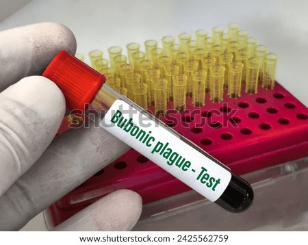 Blood sample for Bubonic plague test. It's one of three types of plague caused by the bacterium Yersinia pestis