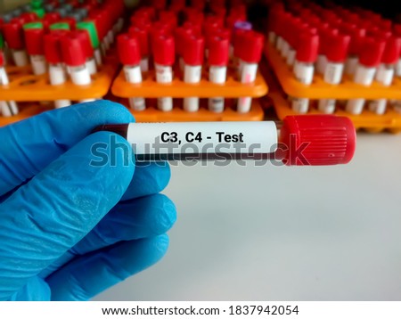 Blood Sample for C3, C4 (Complement) Test with laboratory background. Closeup. Diagnosis of autoimmune disorders. 