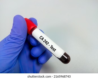 Blood Sample Ca 242 Test Diagnosis Stock Photo 2165968743 | Shutterstock