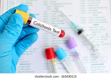 Blood Sample For Calcitonin Hormone Test