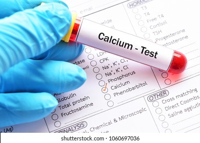 Blood Sample For Calcium Test