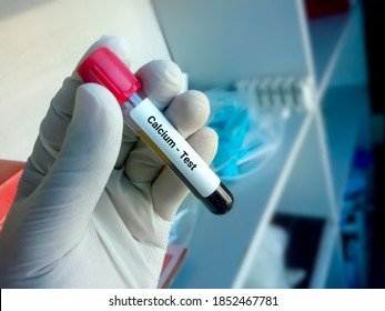 Blood Sample For Calcium Test