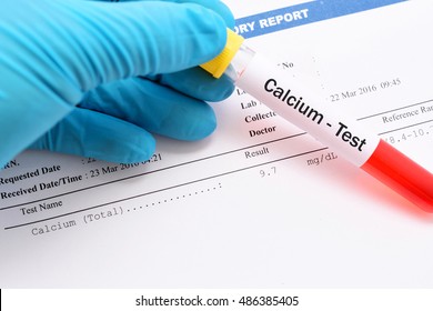 Blood Sample For Calcium Test With Result